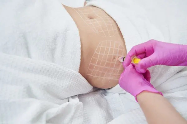 image of fat dissolving injections on love handles to help combat weight gain Broxburn