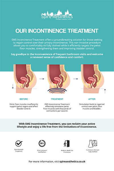 image of how urge incontinence Broxburn treatment works