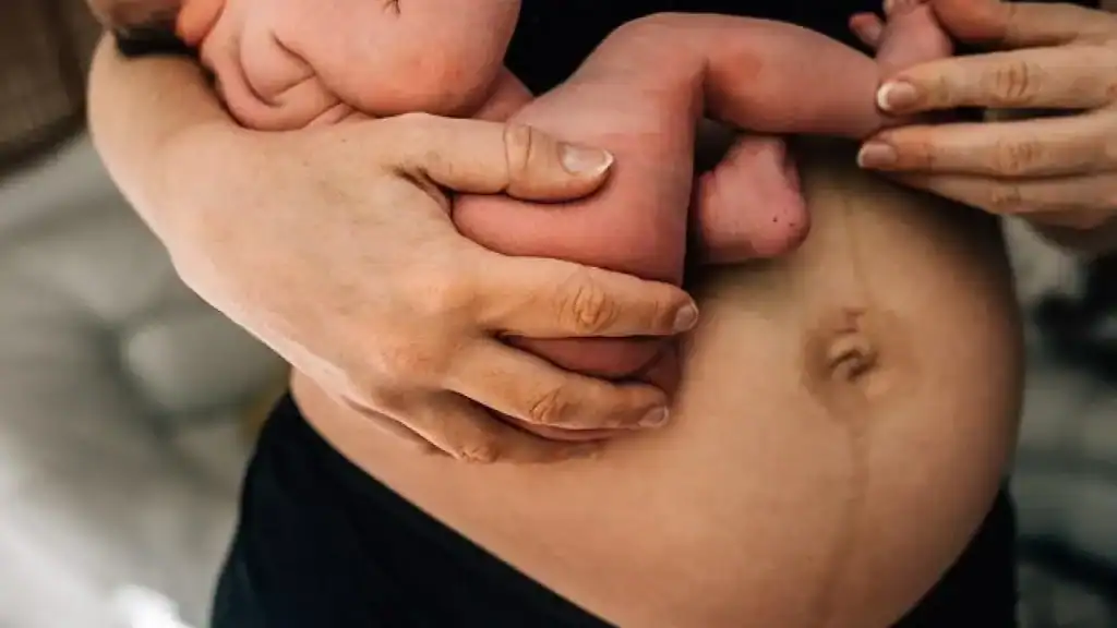 Why Is My Stomach Still Big After Pregnancy Broxburn?